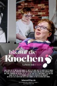 Bis auf die Knochen – Leben mit FOP