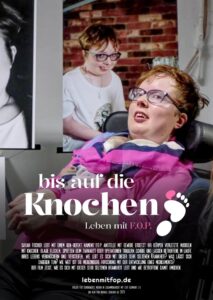 Bis auf die Knochen – Leben mit FOP